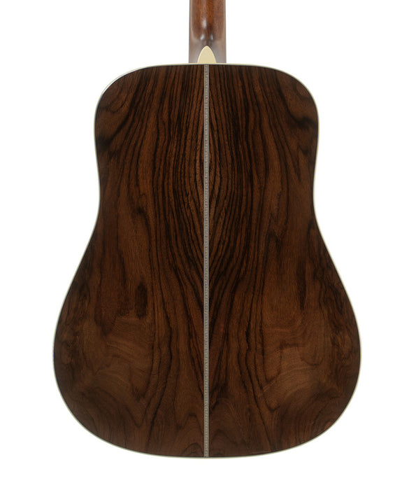 Martin Custom Shop Super-HD 28 Adirondack/Wild Grain Rosewood Acoustic Guitar | New